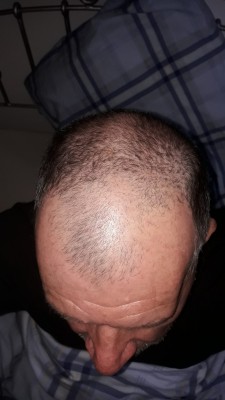 Es sollte reichen, um Corona zu überleben.